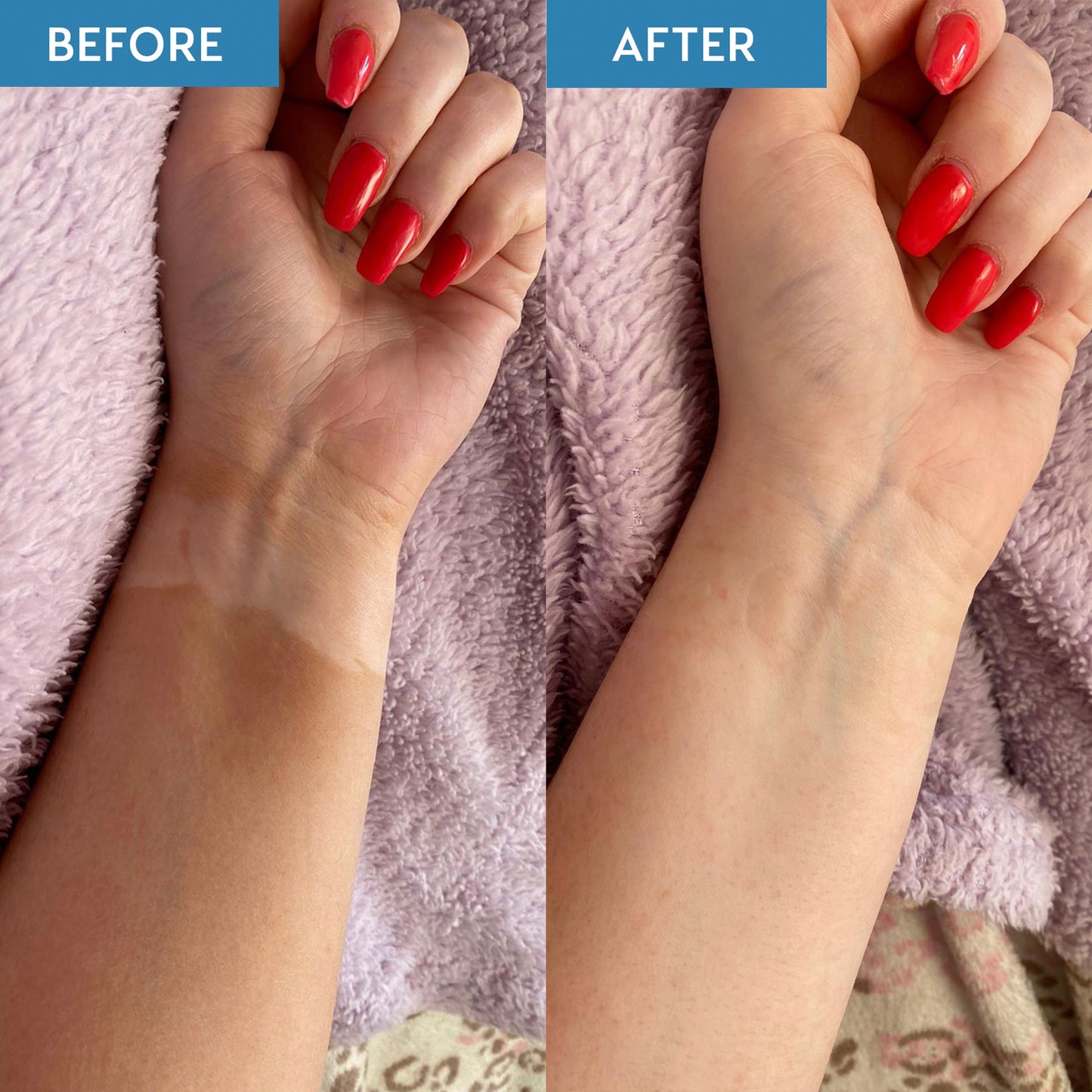Before and after image showing skin before and after using the Tan Remover
and Primer included in the Tanning 101 Bundle. The before image shows patchy tan and the after image shows tan free skin.