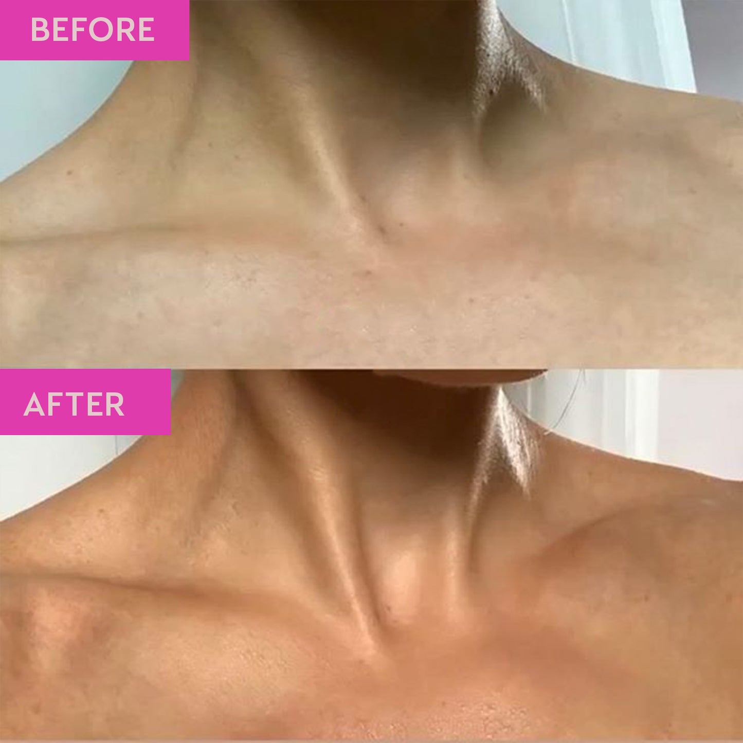 Before and after image showing skin before and after using the products in the Tanning 101 Bundle. The image demonstrates the medium tanning results achieved by the products.