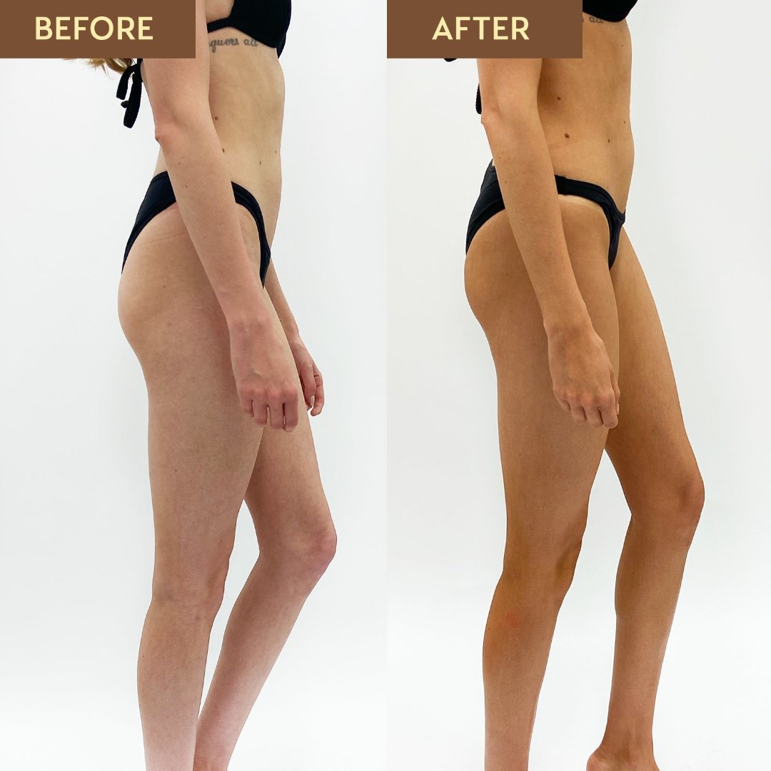 Before and after image of the side of a woman in a black bikini. The before image shows pale skin while the second shows a dark tan following a spray tan with He-Shi Rich bronze