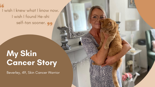Beverley's Skin Cancer Story: Journey to Safe Tanning with He-Shi