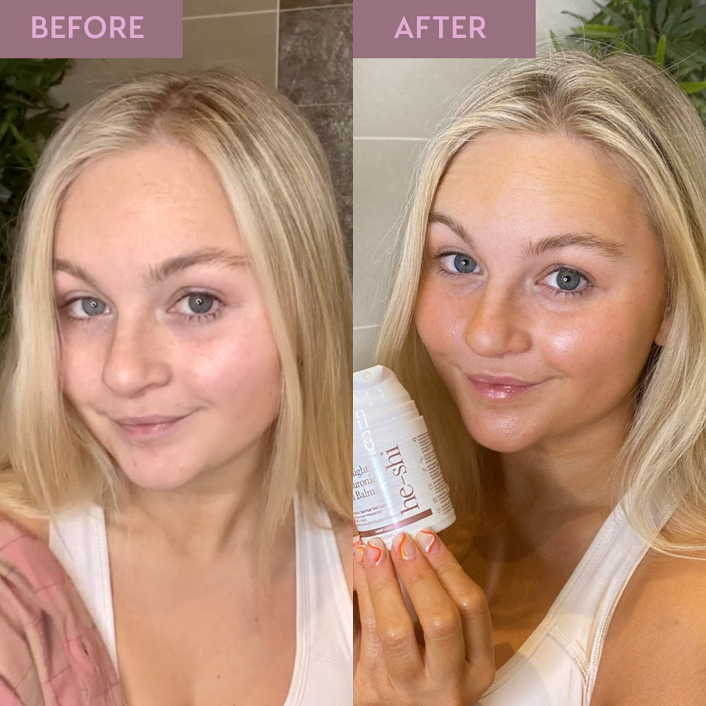 before and after image of woman's face showing more tanned skin in the after photo