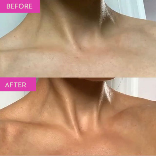 Before and after image showing skin before and after using the products in the Tanning 101 Bundle. The image demonstrates the medium tanning results achieved by the products.