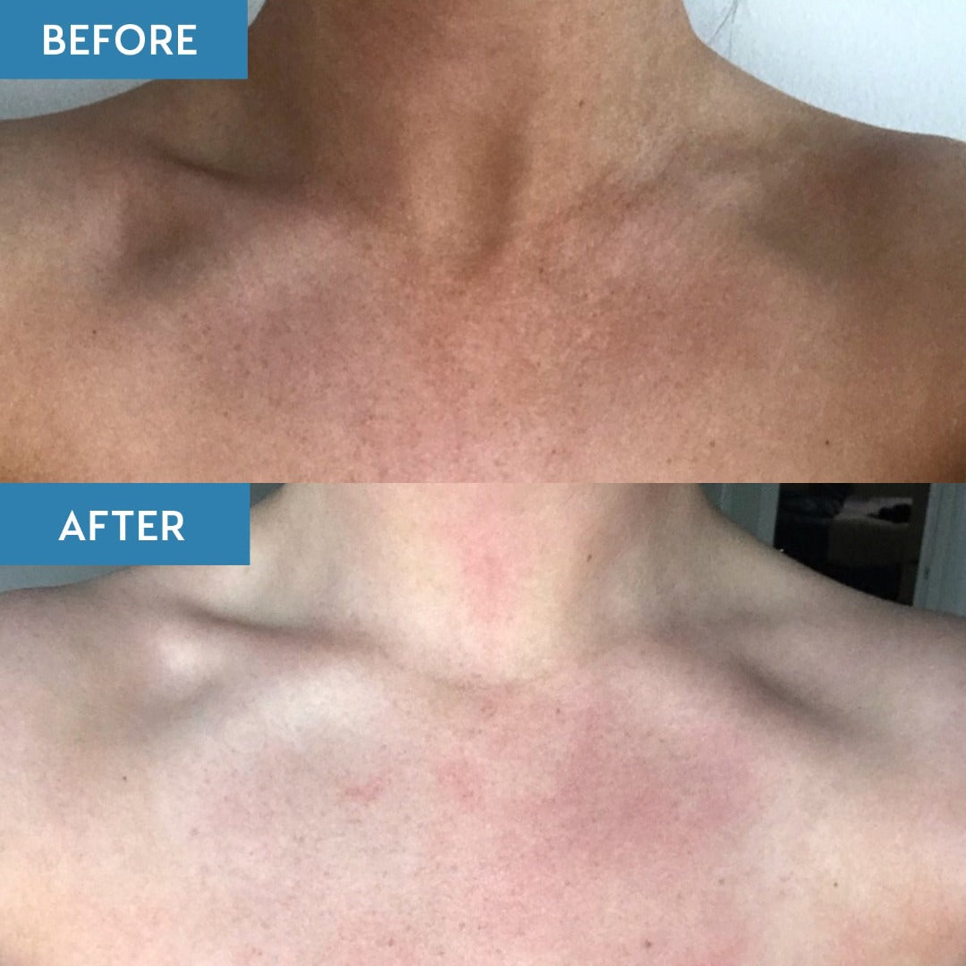 heshi tan remover before and after on a ladies chest area, showing clean skin after use